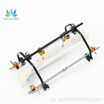 Tibia ex corrección